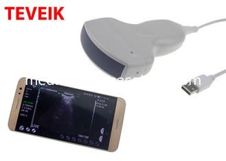 Teveik Medical Wireless Ultrasound Probe Portable Wifi Ultrasound Doppler Machine